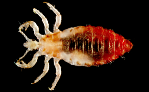 What does head lice look like?