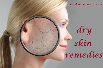 home remedies for dry skin