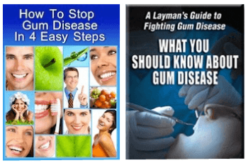 gum-disease-books