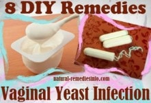 DIY vaginal yeast remedies