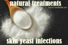 skin yeast infection treatments