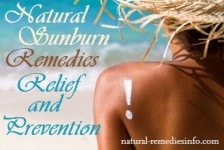 sunburn remedies