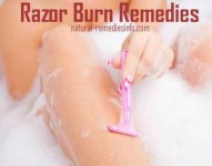 Razor burn remedies